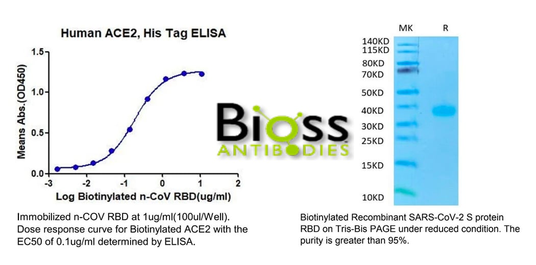 Which Is Better Bsa Vs Non Fat Milk In Western Blot 6882