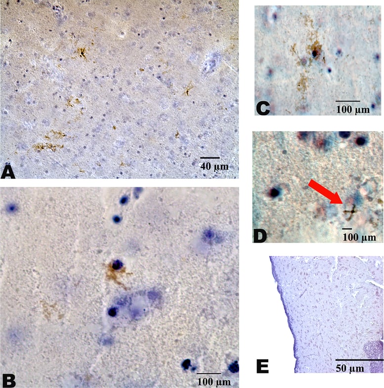 tau gfap staining plosone.png